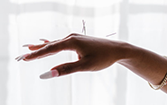 acupuncture