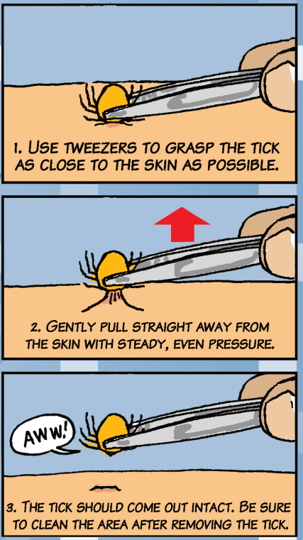 3 steps to safety removing a tick