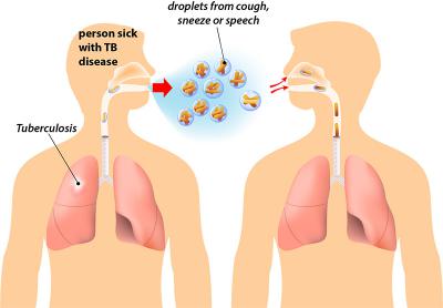 illustration of how TB spreads between people
