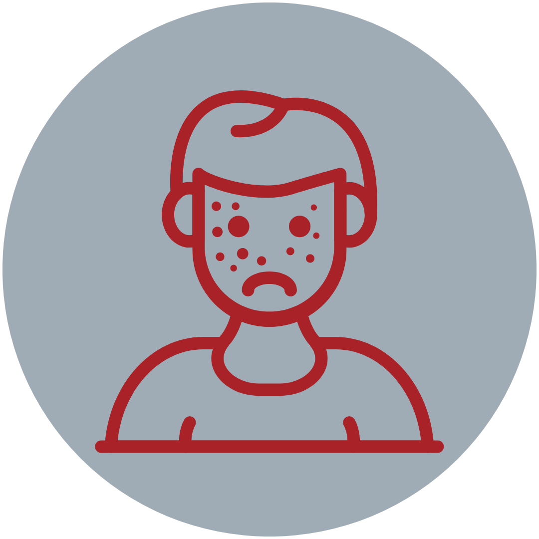 Icon of a frowning child with a measles rash