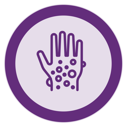 icon of a hand with spots on it