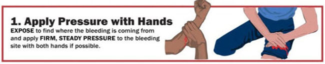 Stop the Bleed step 1 graphic