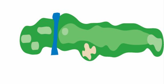 Oaks hole 1